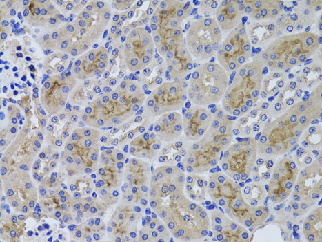 Immunohistochemistry - GGT1 Polyclonal Antibody 