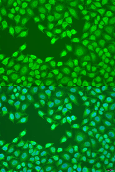 Immunofluorescence - FZD4 Polyclonal Antibody 