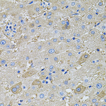 Immunohistochemistry - GLA Polyclonal Antibody 