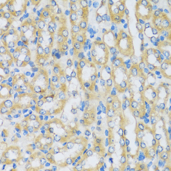 Immunohistochemistry - ARPC1A Polyclonal Antibody 