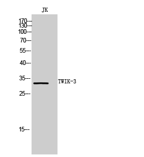 Fig1:; Western Blot analysis of JK cells using TWIK-3 Polyclonal Antibody. Secondary antibody（catalog#: HA1001) was diluted at 1:20000