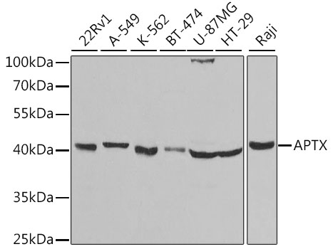 Western blot - APTX Polyclonal Antibody 