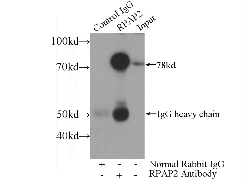 IP Result of anti-RPAP2 (IP:Catalog No:114798, 4ug; Detection:Catalog No:114798 1:1000) with HEK-293 cells lysate 2800ug.