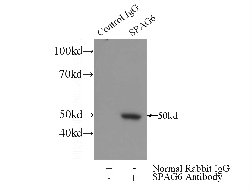 IP Result of anti-SPAG6 (IP:Catalog No:115534, 3ug; Detection:Catalog No:115534 1:300) with mouse testis tissue lysate 4000ug.