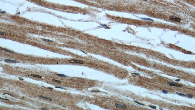 Immunohistochemical of paraffin-embedded human heart using Catalog No:116523(UBE2E3 antibody) at dilution of 1:50 (under 40x lens)