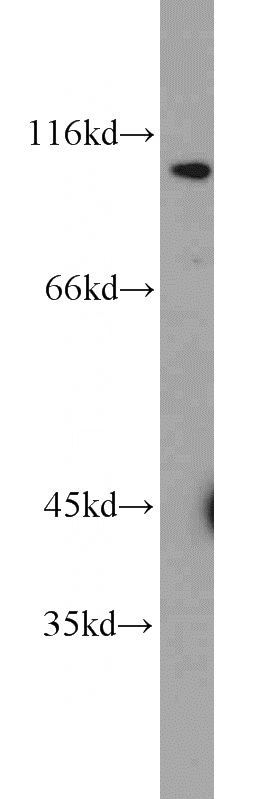 HepG2 cells were subjected to SDS PAGE followed by western blot with Catalog No:112551(MCM10 antibody) at dilution of 1:300