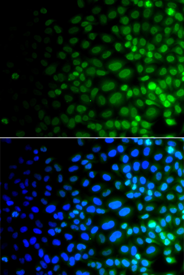 Immunofluorescence - ULK4 Polyclonal Antibody 
