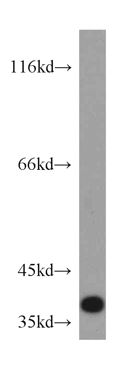 HeLa cells were subjected to SDS PAGE followed by western blot with Catalog No:110600(FAM76A antibody) at dilution of 1:500
