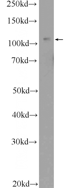 MCF-7 cells were subjected to SDS PAGE followed by western blot with Catalog No:116408(TRPC5 Antibody) at dilution of 1:1000