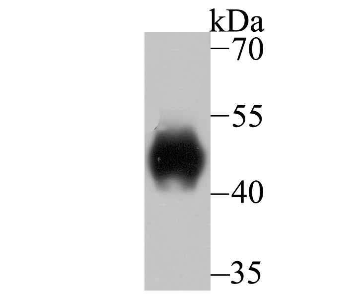 Fig1:; Western blot analysis of LRG1 on human serum lysates. Proteins were transferred to a PVDF membrane and blocked with 5% BSA in PBS for 1 hour at room temperature. The primary antibody ( 1/500) was used in 5% BSA at room temperature for 2 hours. Goat Anti-Rabbit IgG - HRP Secondary Antibody (HA1001) at 1:200,000 dilution was used for 1 hour at room temperature.