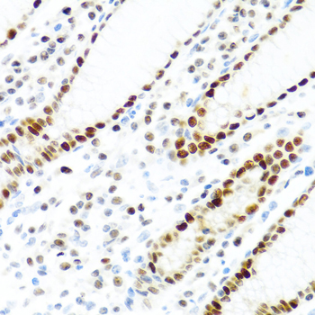 Immunohistochemistry - KHDRBS2 Polyclonal Antibody 