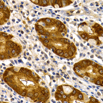 Immunohistochemistry - TFF1 Polyclonal Antibody 