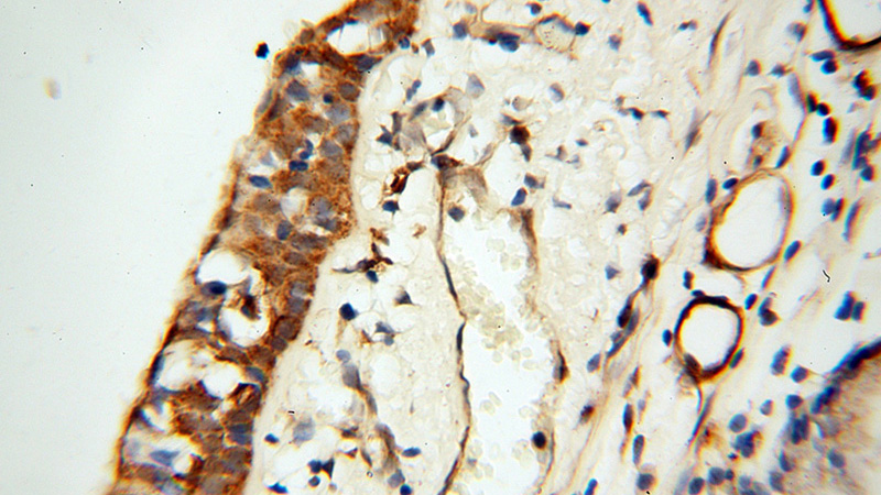 Immunohistochemical of paraffin-embedded human trachea using Catalog No:115937(TEKT2 antibody) at dilution of 1:50 (under 40x lens)