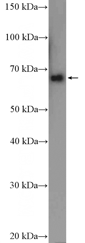 mouse brain tissue were subjected to SDS PAGE followed by western blot with Catalog No:111923(KCNA5 Antibody) at dilution of 1:600