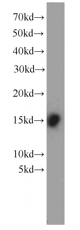 mouse heart tissue were subjected to SDS PAGE followed by western blot with Catalog No:110438(FABP3 antibody) at dilution of 1:1000