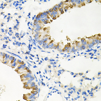 Immunohistochemistry - IRAK2 Polyclonal Antibody 