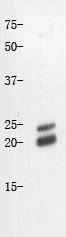 Fig1: Western blot analysis on Mouse liver using anti-Caveolin-1 polyclonal antibody