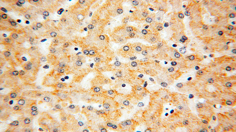 Immunohistochemical of paraffin-embedded human liver using Catalog No:112266(LTF antibody) at dilution of 1:50 (under 40x lens)