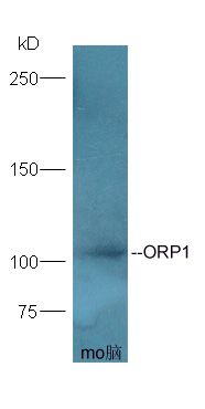 Fig1: Protein: brain(mouse) lystes at 40ug;; Primary: Anti-ORP1 at 1:300;; Secondary: HRP conjugated Goat-Anti-Rabbit IgG(bse-0295G-HRP) at 1: 5000;; ECL excitated the fluorescence;; Predicted band size :108 kD; Observed band size :108 kD