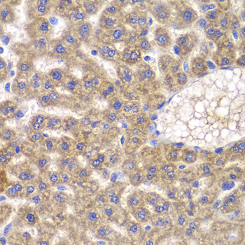 Immunohistochemistry - FASTK Polyclonal Antibody 