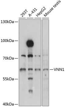 Western blot - VNN1 Polyclonal Antibody 