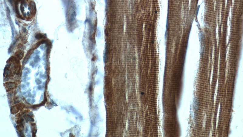 Immunohistochemistry of paraffin-embedded human skeletal muscle tissue slide using Catalog No:108007(PRKAA2 Antibody) at dilution of 1:50 (under 40x lens)