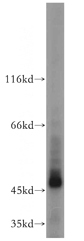 mouse testis tissue were subjected to SDS PAGE followed by western blot with Catalog No:110828(GAL3ST1 antibody) at dilution of 1:500