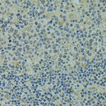 Immunohistochemistry - IVNS1ABP Polyclonal Antibody 
