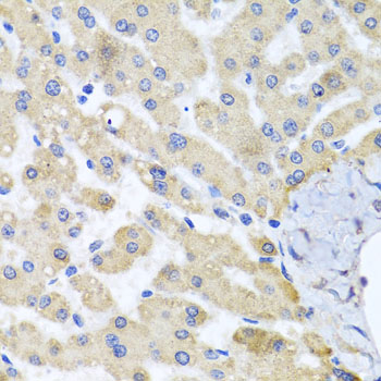 Immunohistochemistry - ABCB8 Polyclonal Antibody 