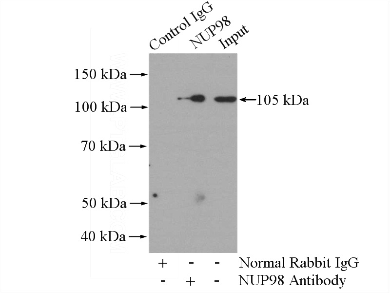 IP Result of anti-NUP98-NUP96 (IP:Catalog No:113386, 4ug; Detection:Catalog No:113386 1:1000) with COLO 320 cells lysate 2000ug.