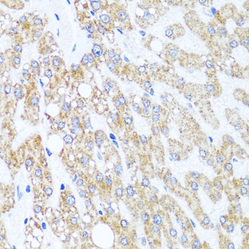 Immunohistochemistry - CHD1 Polyclonal Antibody 