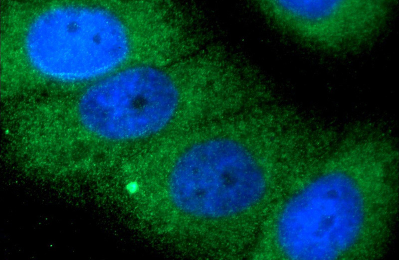 Immunofluorescent analysis of HepG2 cells using Catalog No:115941(TELO2 Antibody) at dilution of 1:25 and Alexa Fluor 488-congugated AffiniPure Goat Anti-Rabbit IgG(H+L)