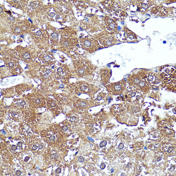 Immunohistochemistry - CNR1 Polyclonal Antibody 