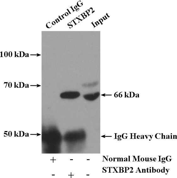 IP Result of anti-STXBP2 (IP:Catalog No:107611, 5ug; Detection:Catalog No:107611 1:2000) with K-562 cells lysate 3200ug.
