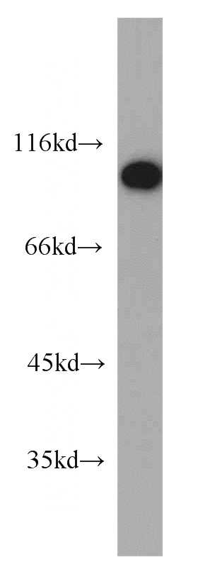 human testis tissue were subjected to SDS PAGE followed by western blot with Catalog No:109622(CTAGE5 antibody) at dilution of 1:300