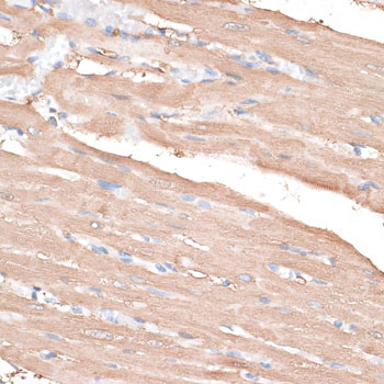 Immunohistochemistry - KIF14 Polyclonal Antibody 