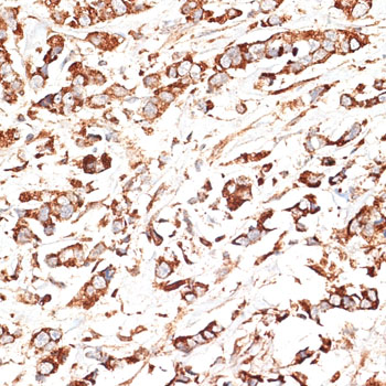 Immunohistochemistry - KLHL9 Polyclonal Antibody 
