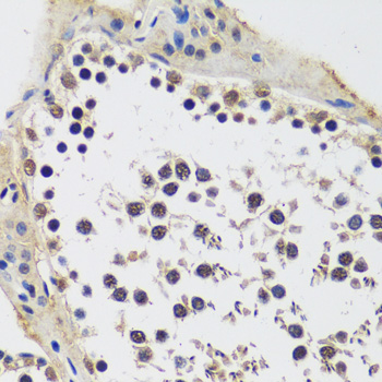 Immunohistochemistry - CCDC59 Polyclonal Antibody 