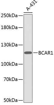 Western blot - BCAR1 Polyclonal Antibody 