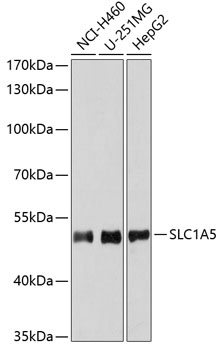 Western blot - SLC1A5 Polyclonal Antibody 