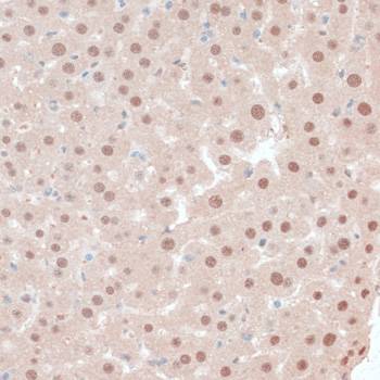 Immunohistochemistry - ZNF562 Polyclonal Antibody 