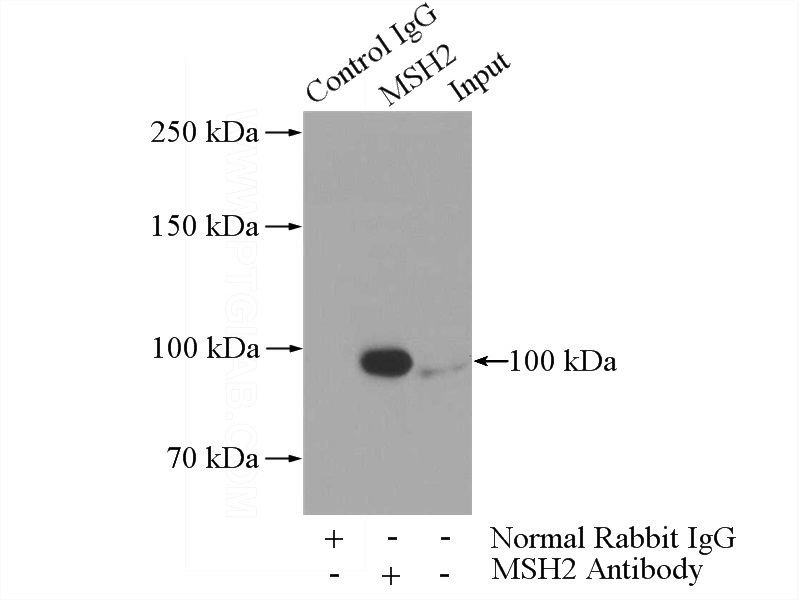 IP Result of anti-MSH2 (IP:Catalog No:112867, 5ug; Detection:Catalog No:112867 1:500) with HeLa cells lysate 2000ug.