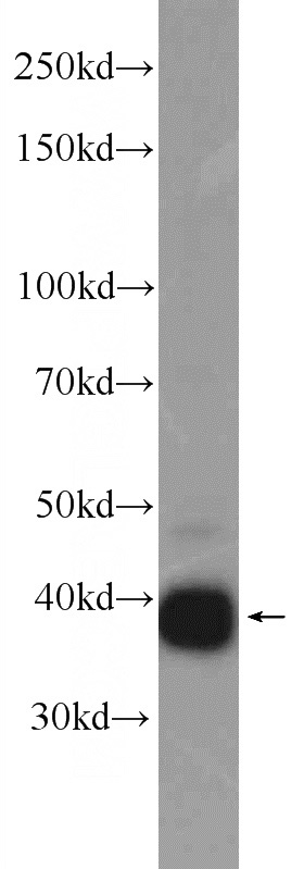 MDA-MB-453s cells were subjected to SDS PAGE followed by western blot with Catalog No:112324(LRPAP1 Antibody) at dilution of 1:1000
