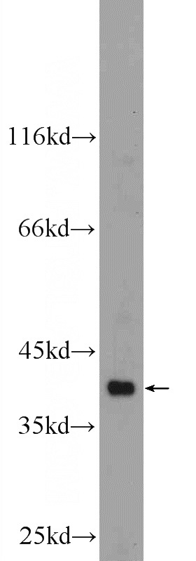mouse skeletal muscle tissue were subjected to SDS PAGE followed by western blot with Catalog No:108092(ANXA13 Antibody) at dilution of 1:1000