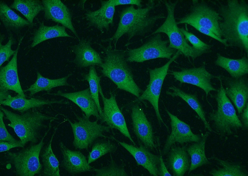Immunofluorescent analysis of NIH/3T3 cells using Catalog No:110635(FGF5 Antibody) at dilution of 1:50 and Alexa Fluor 488-congugated AffiniPure Goat Anti-Rabbit IgG(H+L)