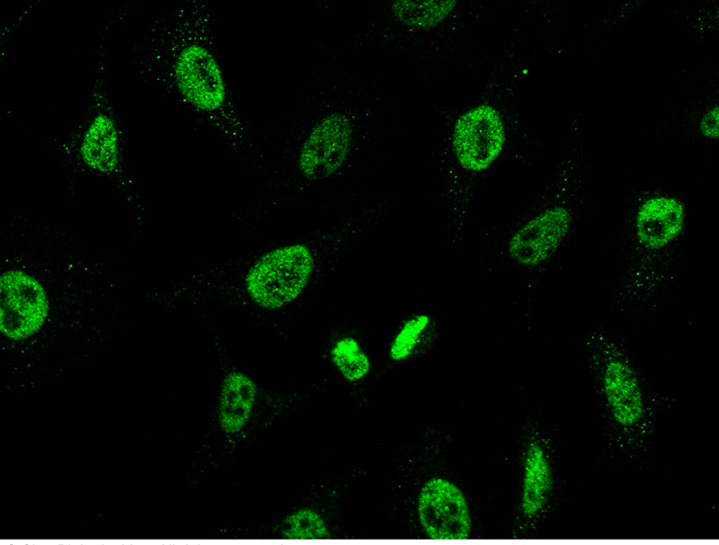 Human CHD4 Immunofluorescence(IF) 15988