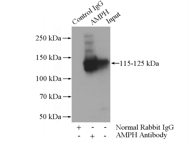IP Result of anti-AMPH (IP:Catalog No:108004, 4ug; Detection:Catalog No:108004 1:1500) with mouse brain tissue lysate 4000ug.