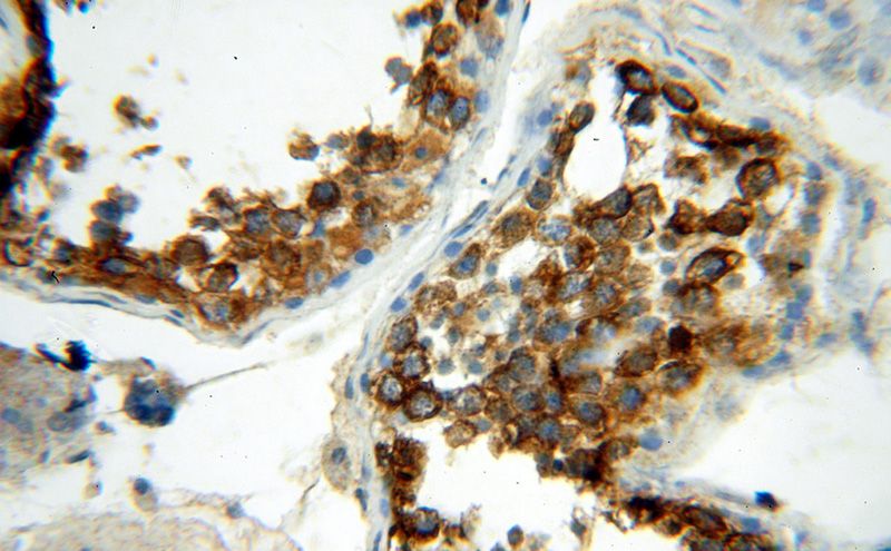 Immunohistochemical of paraffin-embedded human testis using Catalog No:111380(HDAC6 antibody) at dilution of 1:50 (under 40x lens)