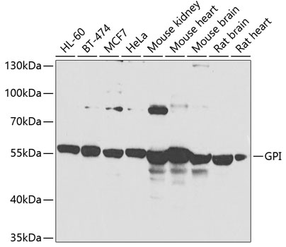 Western blot - GPI Polyclonal Antibody 