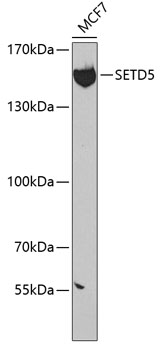 Western blot - SETD5 Polyclonal Antibody 